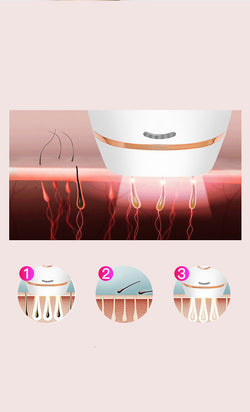 Permanent Hair Removal Device Deal #58